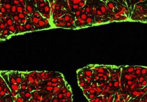 العلماء يخترقون حاجز المخ لعلاج المرضى
