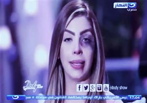 مذيعة النهار تظهر بآثار ضرب وكدمات وعنف على وجهها