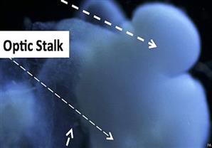 تخليق دماغ "جنين" صناعي لدراسة اضطرابات المخ