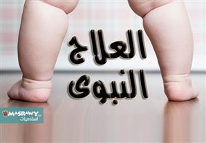 كيف عالج الإسلام مرض السمنة والوزن الزائد؟