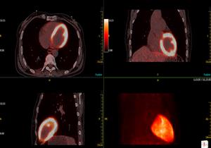 نيوسوفت تصدر جهاز التصوير "NeuSight PET/CT" للأسواق العالمية