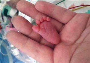 بالصور.. أصغر رضيعة في العالم.. بوزن "حبة فلفل"!