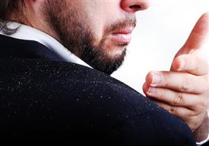 هذه العادات الخاطئة تصيبك بقشرة الشعر