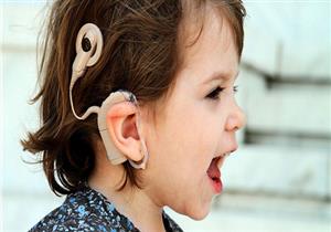 منها شلل الوجه.. 4 مخاطر تسببها زراعة قوقعة الأذن لطفلِك