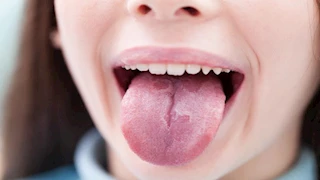 لسانك يكشف أسرار صحتك.. طبيبة تحذر من علامات تنذر بأمراض خطيرة