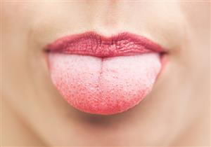 من فمك.. علامة تكشف الإصابة بنقص فيتامين B12