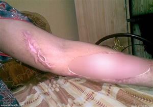 سبت زوجها.. فكانت عقوبتها "الحرق"