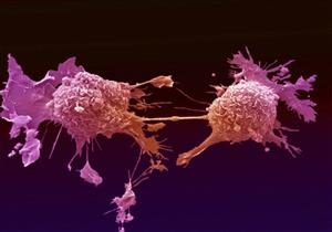 تقنية جديدة تدمر الخلايا السرطانية خلال ثلاثة أيام 