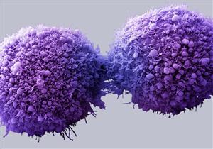 اكتشاف جزئيات في الحمض النووي قادرة على قتل الخلايا السرطانية 
