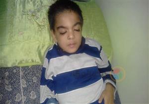 علاجه غير موجود في مصر.. قصة طفل يعاني من مرض نادر بكفر الشيخ