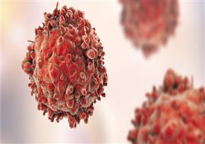 تكنولوجيا جديدة تدمر الخلايا السرطانية المنتشرة في الدم.. كيف ذلك؟