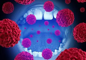 مدته 60 ثانية.. فحص بسيط يمكنك من اكتشاف سرطان الفم