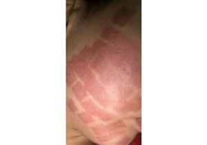 "ولاء": "شوهوا وشي قبل فرحي بأسبوع".. ومركز التجميل: "محاولة ابتزاز" (صور) 