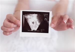 لماذا يحدث «الحمل العنقودي» وما خطورته؟
