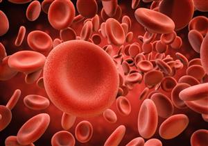 مضاعفات خطيرة لسيولة الدم.. إليك الأسباب والأعراض