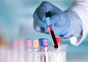 اختبار دم جديد يكشف عن 10 أنواع من السرطان