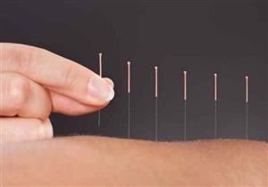    للمرة الأولى.. منظمة الصحة العالمية تشمل الطب الصيني الشعبي ضمن مرجعيتها