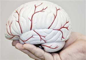 تحليل جديد للدم بديل عن الأشعة المقطعية على المخ