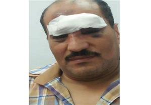 رشقه صبية بالحجارة.. إصابة سائق قطار القاهرة/ المنصورة في الرأس