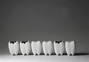 تسوس الأسنان.. الأسباب والعلاج وطرق الوقاية