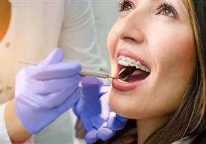 انتكاس تقويم الأسنان.. الأسباب وطرق الوقاية والعلاج