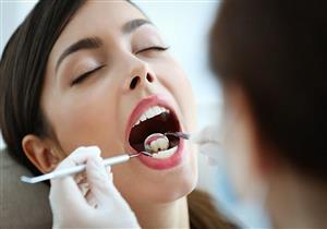 التهاب عصب الأسنان.. الأسباب والأعراض وطرق العلاج