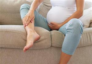 تورم الأطراف أثناء الحمل.. متى ينذر بمشكلات خطيرة؟