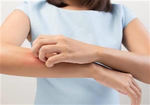 أعراض فيروس كورونا.. كيف تؤثر على الجلد؟