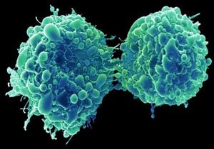 اكتشاف فيروس جديد يمكنه القضاء على الخلايا السرطانية