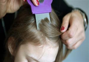 قبل دخول المدراس.. 7 طرق لوقاية طفلِك من قمل الشعر (إنفوجرافيك)