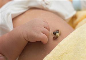 متى تسقط سرة الرضيع؟.. دليلِك للعناية بجذع الحبل السري بعد الولادة