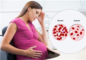 فقر الدم أثناء الحمل– هل يسبب الإجهاض؟ 