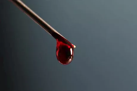 7 أمراض قد تسبب البراز الدموي- متى يستدعي القلق؟ 