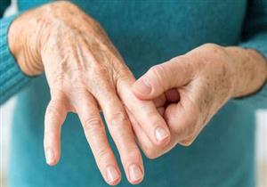 5 أنواع من التهاب المفاصل تؤثر على اليدين