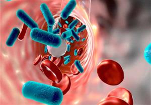 حالة تهدد الحياة.. ما الذي يسبب "تعفن الدم" في الجسم وكيف تمنعه؟