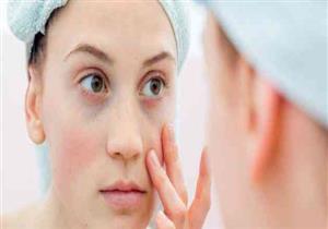 تحذير: تورم الوجه علامة على الإصابة بسرطان الرئة