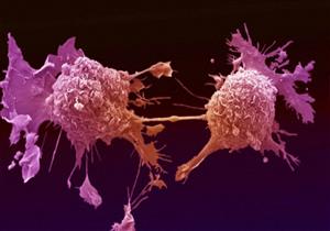  ابتكار تقنية مناعية جديدة لتدمير الخلايا السرطانية