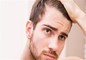 أغربها الكركديه.. 7 علاجات بديلة لتساقط الشعر عند الرجال (صور)