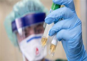 مسئول كويتي: نتائج عينة المصري المشتبه في إصابته بـ"كورونا" سلبية