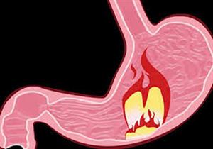 لمرضى التهابات المعدة.. كيف تهيئ نفسك للصيام؟