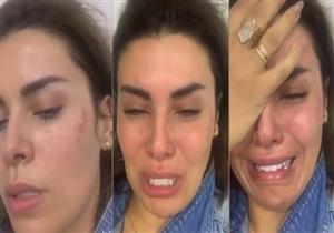 فيديو| الفنانة أماني السويسي تتهم متعهد حفلات بالتعدي عليها بالضرب