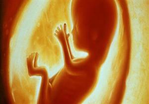 دراسة: السمنة أثناء الحمل تهدد بوفاة الأجنة