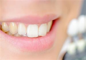 4 مشكلات صحية تؤثر على لون أسنانك