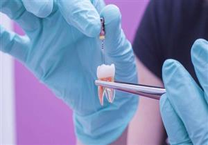 متى يكون حشو عصب الأسنان ضروريًا؟ (فيديوجرافيك)