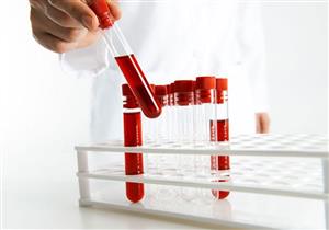 فوائد مهمة من إجراء تحليل الفوسفور في الدم