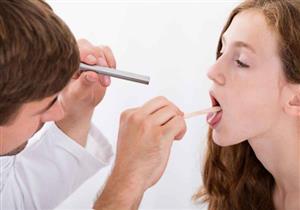 خبراء: 3 أعراض على اللسان قد تكون مؤشرا على الإصابة بالسرطان