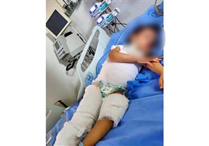 "سلخوها وأحرقوا جسمها بالسجائر".. القبض على عم وعمة الطفلة "دولت"