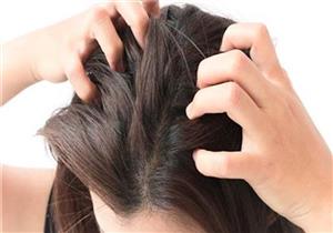 أضرار التعرق على صحة الشعر.. هكذا يمكنك الوقاية منه