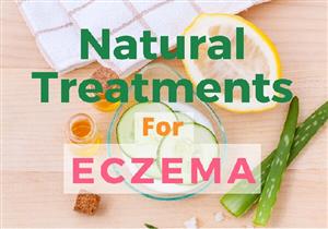 علاج الإكزيما في المنزل.. 4 طرق طبيعية قد تساعدك