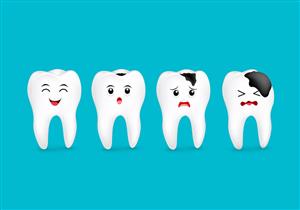 ماذا يحدث عند تسوس الأسنان؟.. 5 مراحل تمر بها أسنانك